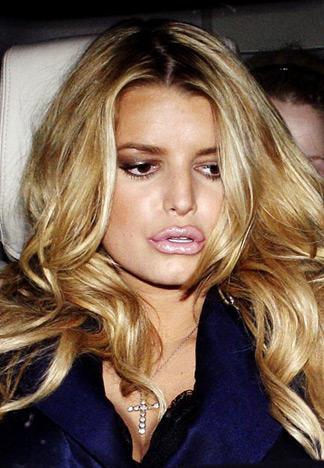 Jessica Simpson logjiski... Autors: sanity Plastic Surgery Nightmares!