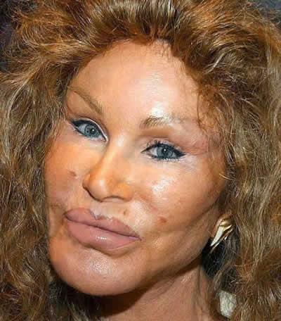 Jautājums Jocelyn Wildenstein ... Autors: mojitogirl Jautājumi un atbildes slavenībām 3.