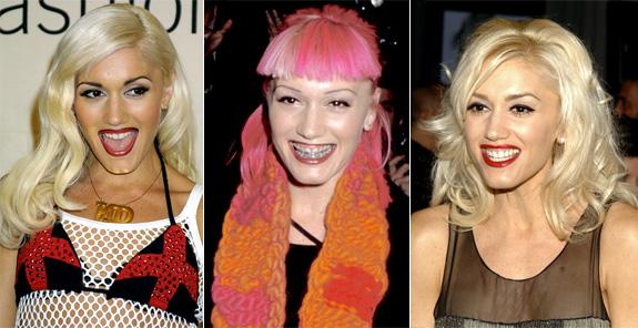Gwen Stefani bija tā retā... Autors: UglyPrince Slevenību Zobi