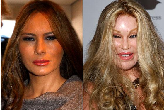  Autors: mazakuce Jocelyn Wildenstein