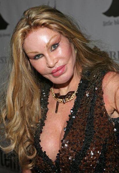  Autors: mazakuce Jocelyn Wildenstein