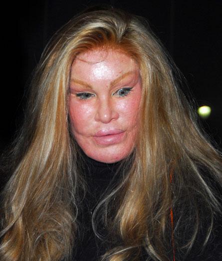  Autors: mazakuce Jocelyn Wildenstein