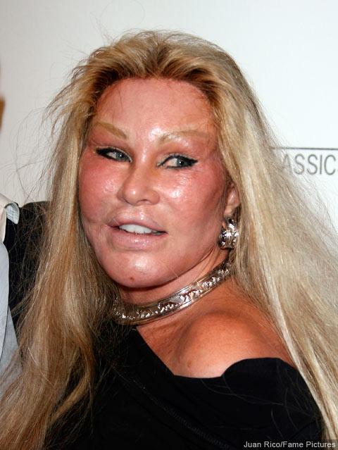  Autors: mazakuce Jocelyn Wildenstein