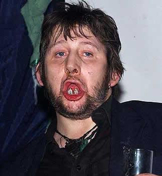 8 Shane MacGowan This Irish... Autors: Fosilija Neglītāko slavenību TOP 20!