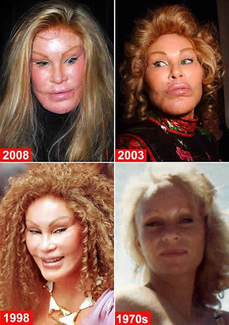 Jocelyn Wildenstein  4 miljonu... Autors: ruutel Plastiskās operācijas