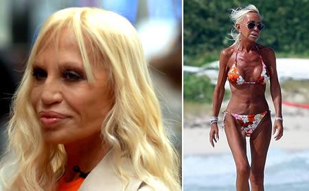 Donatella Versace  Pārņemot... Autors: ruutel Plastiskās operācijas