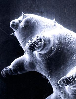 Gauskāji mikroskopisko... Autors: blond Grūti nogalināmās radības