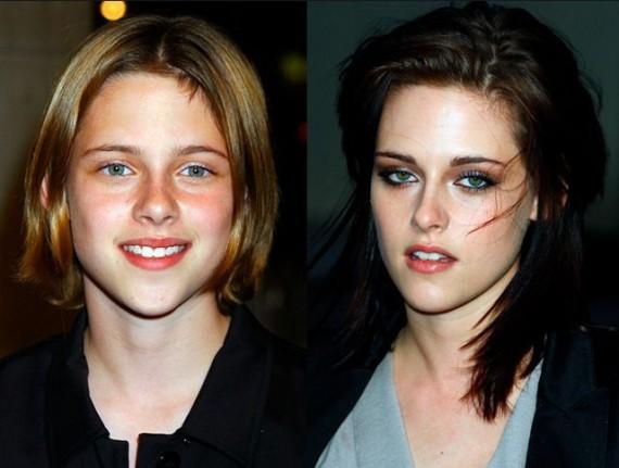 Kristen Stewart Autors: GoodMorningStarshine 45 Slavenības Toreiz vs. Tagad.