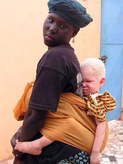  Autors: agonywhispers albīnisms..