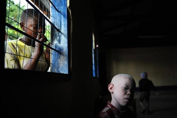 9 gadīgais Amans sēž... Autors: marju6ka Āfrikas albīni