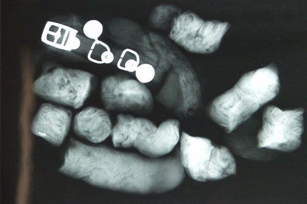 3metrigā pitona rentgens kurš... Autors: BīstamāGramatika Čūska apēda kazu!