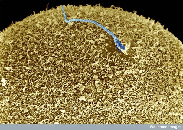 Spermatozīds apauģļo olšūnu Autors: MILFS "2" Aplūkojot pasauli ar mikroskopu