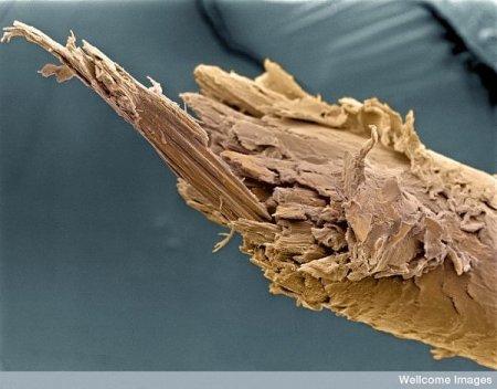 Mata gals Autors: Karapietka Cilvēks zem mikroskopa.