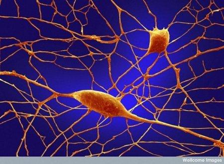 Neironi Autors: Karapietka Cilvēks zem mikroskopa.