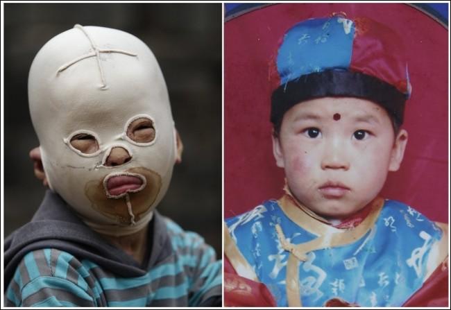 Vangs Genksjangs no kāda maza... Autors: ainiss13 Zēns bez sejas