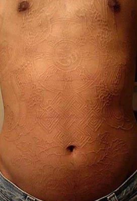  Autors: kjekata scarification