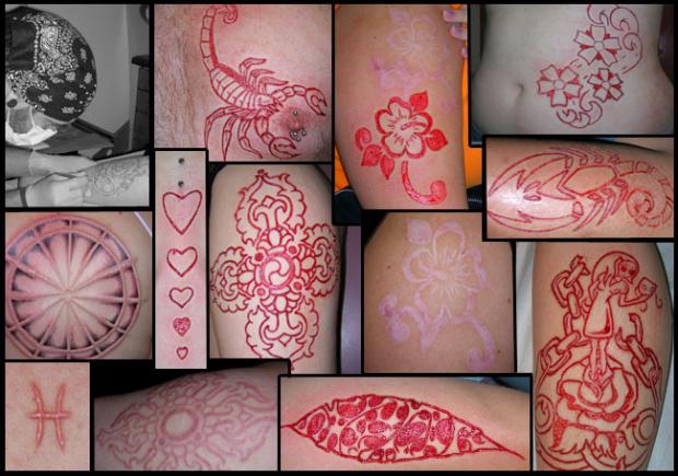  Autors: kjekata scarification