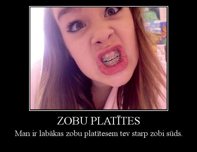  Autors: Ledusputns Zobu platītes