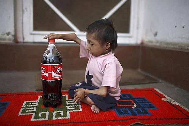 Esmu lielāks par CocaColas... Autors: dunduciene Pasaulē mazākais cilvēks sasniedz pilngadību un meklē s