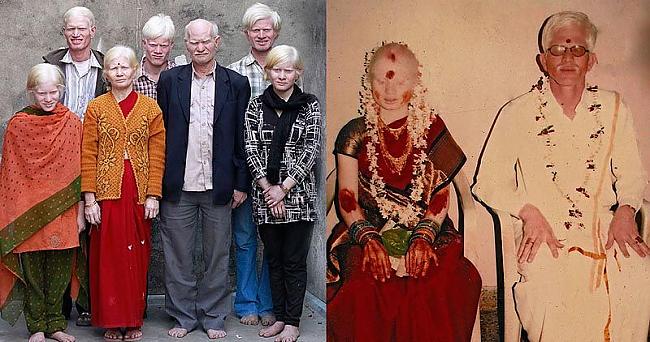 nbspPati lielākā albīnu ģimene... Autors: Administrācija Visa ģimene albīni