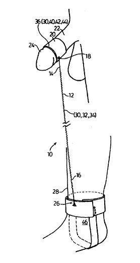 nbspKustīga dzimumlocekļa... Autors: Mozus 7 slimi, intīmi patenti