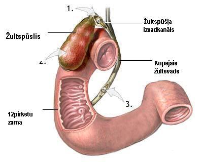 Žultsakmeņi.