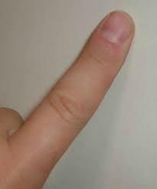 Katrs cilvēka pirksts mūža... Autors: 1245 Baigie fakti par tevi un parējiem cilvēkiem!(ja vien tu esi cilvēks)