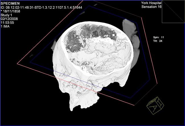 Kopscaron smadzeņu... Autors: xd Atrastas 2500 gadus vecas smadzenes