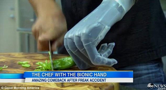 Protams sākotnēji Eduardo... Autors: MJ Pavārs ar bionisko roku!!