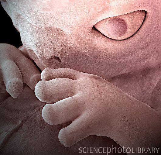 8 nedēļas vecs cilvēka embrijs Autors: Fosilija Things in close up