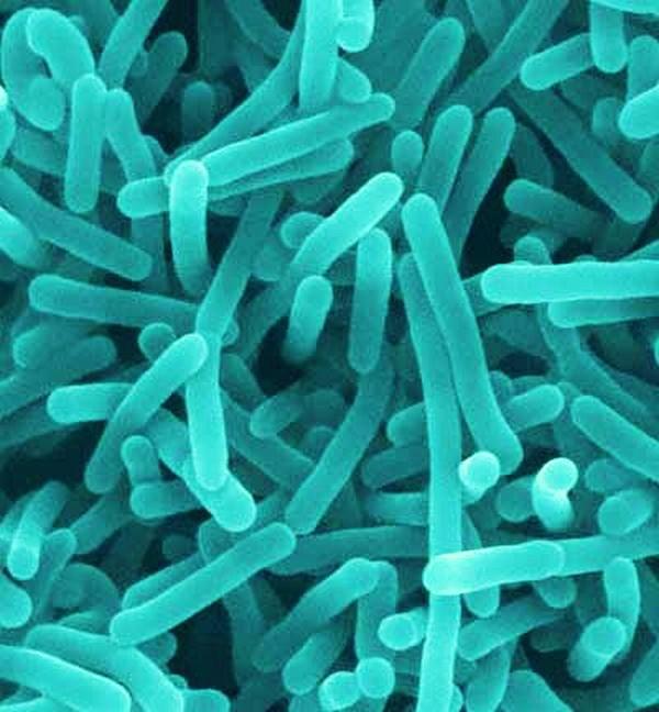 Mūsu ķermenī pastāvīgi mājo... Autors: MONTANNA Kā baktērijas atšķiras no vīrusiem?