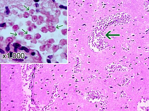 naegleria fowlerinbspsastopams... Autors: HotDogBaby267 parazīti - interesanti un pretīgi.