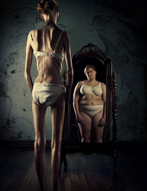 Scaronī ir klasiskā anorexia... Autors: Vampire Lord Anorexia