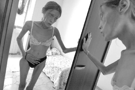 Smaga anoreksija ir dzīvībai... Autors: Vampire Lord Anorexia
