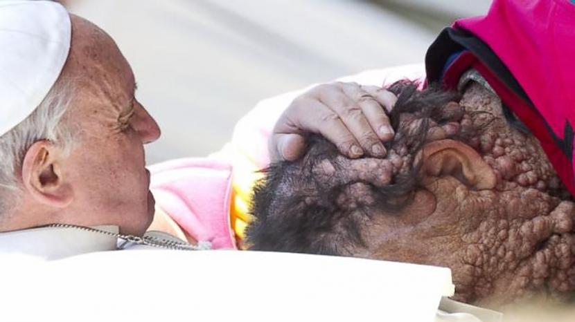 Pāvests Francis aptver kāda... Autors: pofig 21. gadsimta spēcīgākās fotogrāfijas