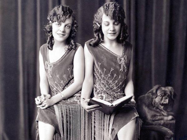 Deizija un Violeta Hiltones... Autors: Vampire Lord Slavenākie Siāmas dvīņi