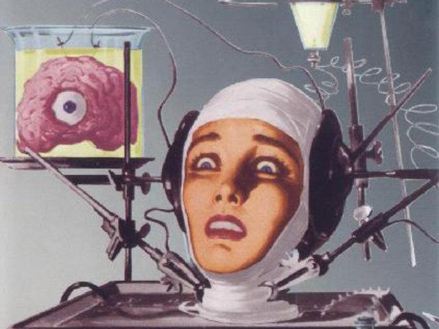 Pats Dr Kanavero ir optimisma... Autors: Prāta Darbnīca Cilvēka galvas transplantācija - jau drīzumā