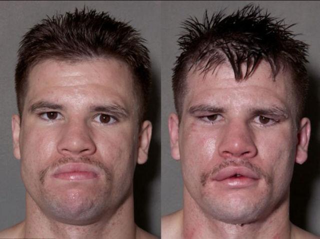 Izskatās skarbinbsplosis Autors: olološD Bokseru sejas pirms un pēc kautiņiem.