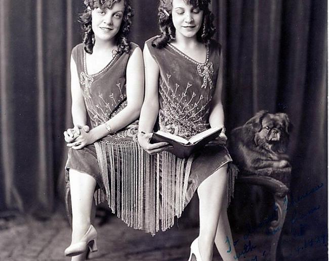 Deizija un Violeta Hiltones... Autors: Lords Lanselots Siamas dvīņu skumīgais dzīves stāsts!!!