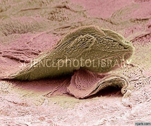  Autors: uzmanību cirvis Tava āda mikroskopā