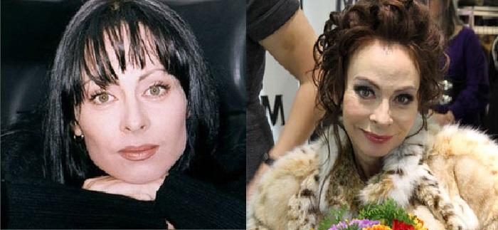 Marina Hļebņikova Autors: Volāns Sievietes pirms un pēc plastiskās operācijas