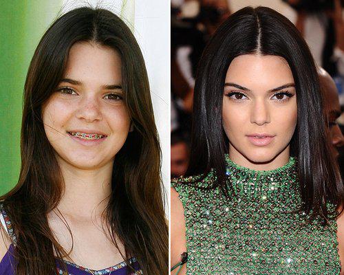 Kendall Jenner Autors: StarGirl83 Slavenības: pirms un tagad
