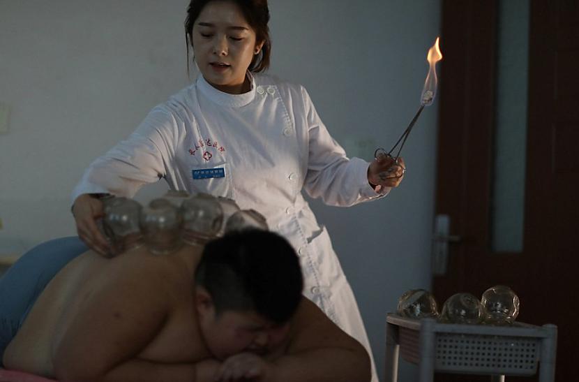  Autors: matilde 150kg smagais bērns cenšas zaudēt svaru ar uguns palīdzību