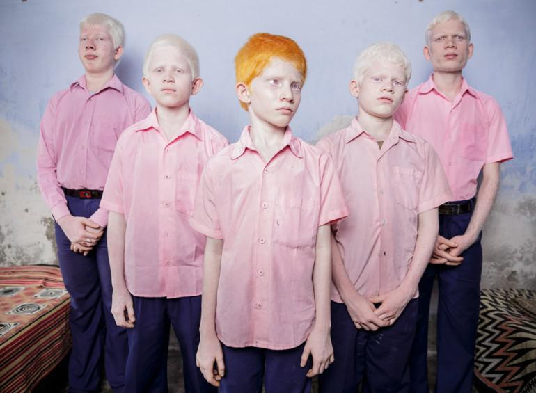 Akli albīnu bērni speciālajā... Autors: 100 A 35 emocionālas planētas iedzīvotāju bildes. Cilvēki ir tik dažādi