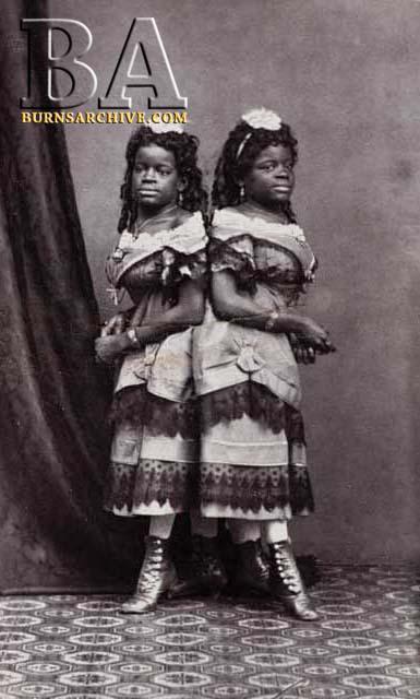 Siāmas dvīnes Millija un... Autors: Svētdiena Amerikāņu cirka «slavenākie» frīki 19. gadsimtā