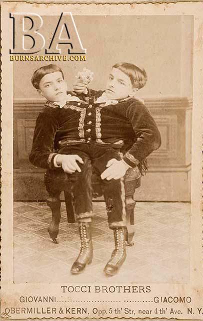 Siāmas dviņi  Džiovanni un... Autors: Svētdiena Amerikāņu cirka «slavenākie» frīki 19. gadsimtā