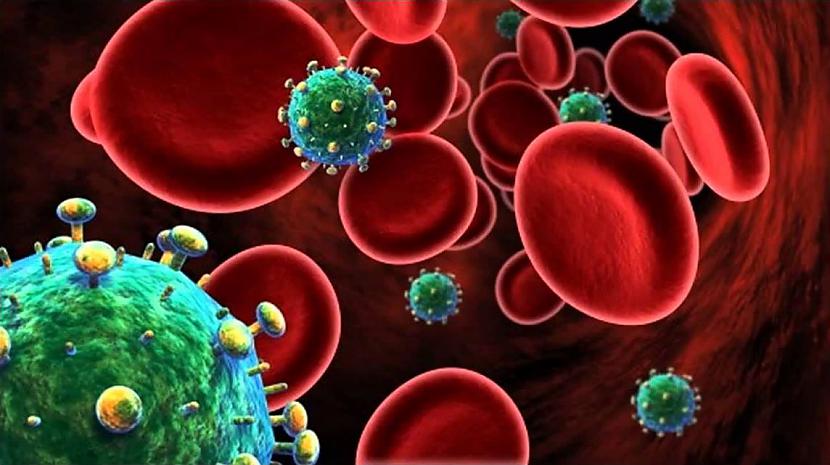 HIV  AIDSVēl viena slimība kas... Autors: Lestets Nāvējošākie vīrusi vēsturē