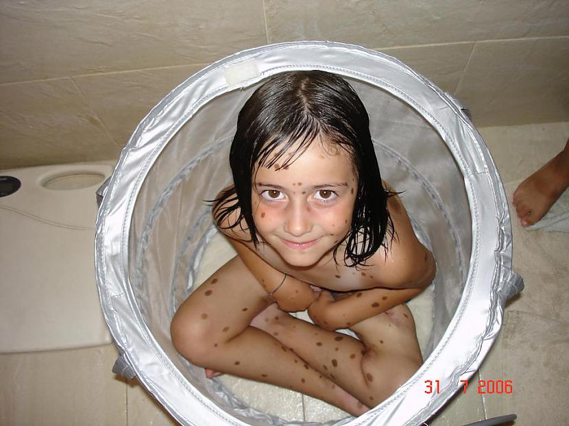 Jau piecu gadu vecumā Alba... Autors: matilde Meitene, kuras ķermeni klāj vairāk nekā 500 dzimumzīmes, ir kļuvusi par modeli