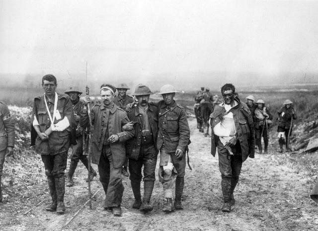 Ievainoti britu karavīri... Autors: Lestets Kauja pie Sommas - asiņainākā kauja vēsturē