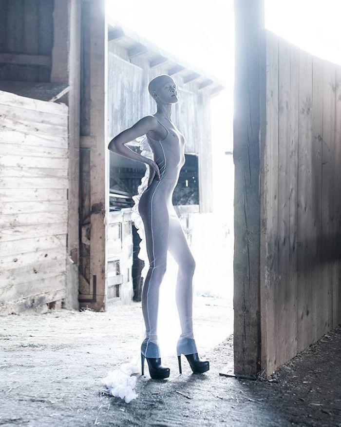 Pirmos slavas laurus Melānija... Autors: matilde Neparastā 28 gadus vecā modele salauza modes industriju ar savu izskatu!